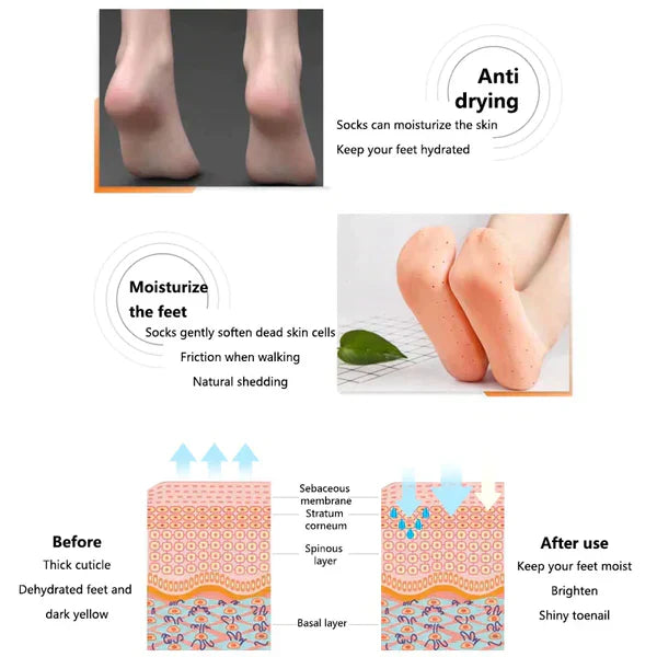 Anti-cracking and Moisturizing feet - Trend Oye.