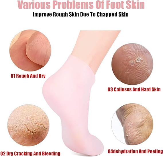 Anti-cracking and Moisturizing feet - Trend Oye